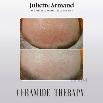 Image for Ceramide Therapy